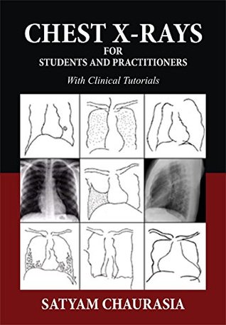 Download CHEST X-RAYS FOR STUDENTS AND PRACTITIONERS ebook by SATYAM CHAURASIA: With Clinical Tutorial - 24by7 Publishing | ePub